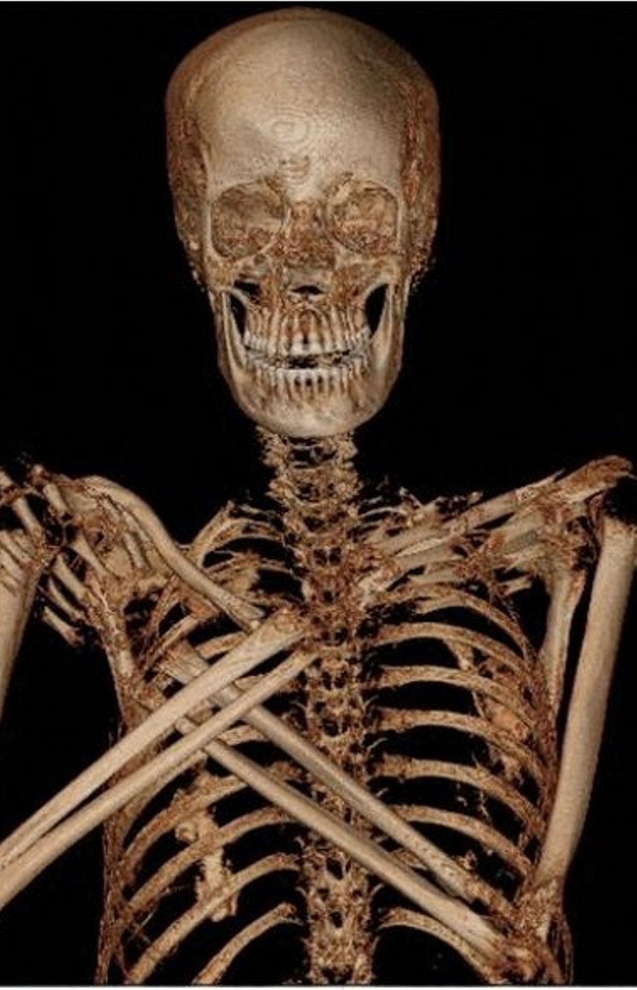 Le squelette de la momie reconstitué en 3D grâce à l'imagerie médicale