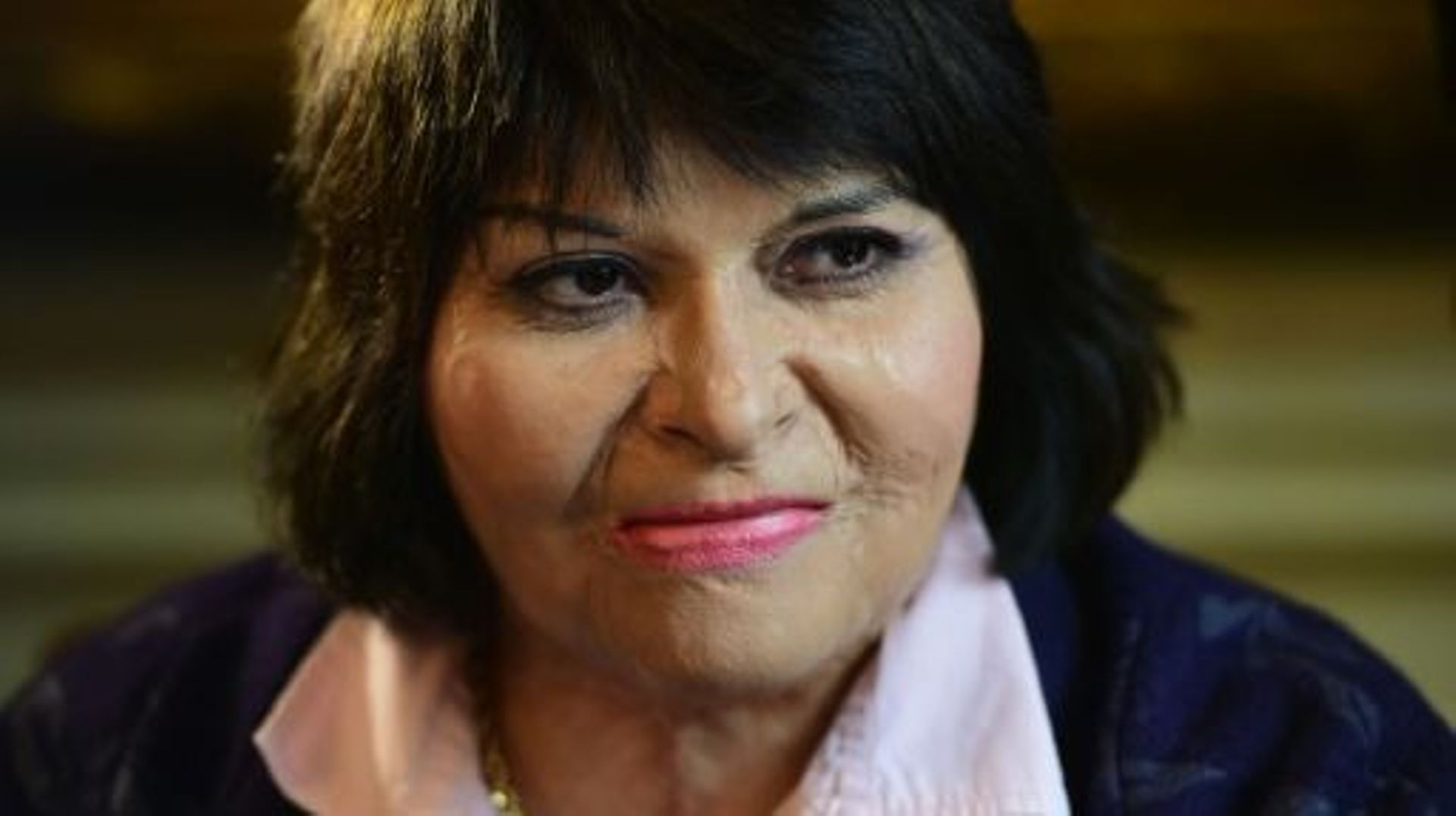 Carmen Gloria Quintana, qui avait été brûlée par des militaires en 1986, tout comme son ami Rodrigo Rojas de Negri, en conférence de presse à Santiago, au Chili, le 27 juillet 2015