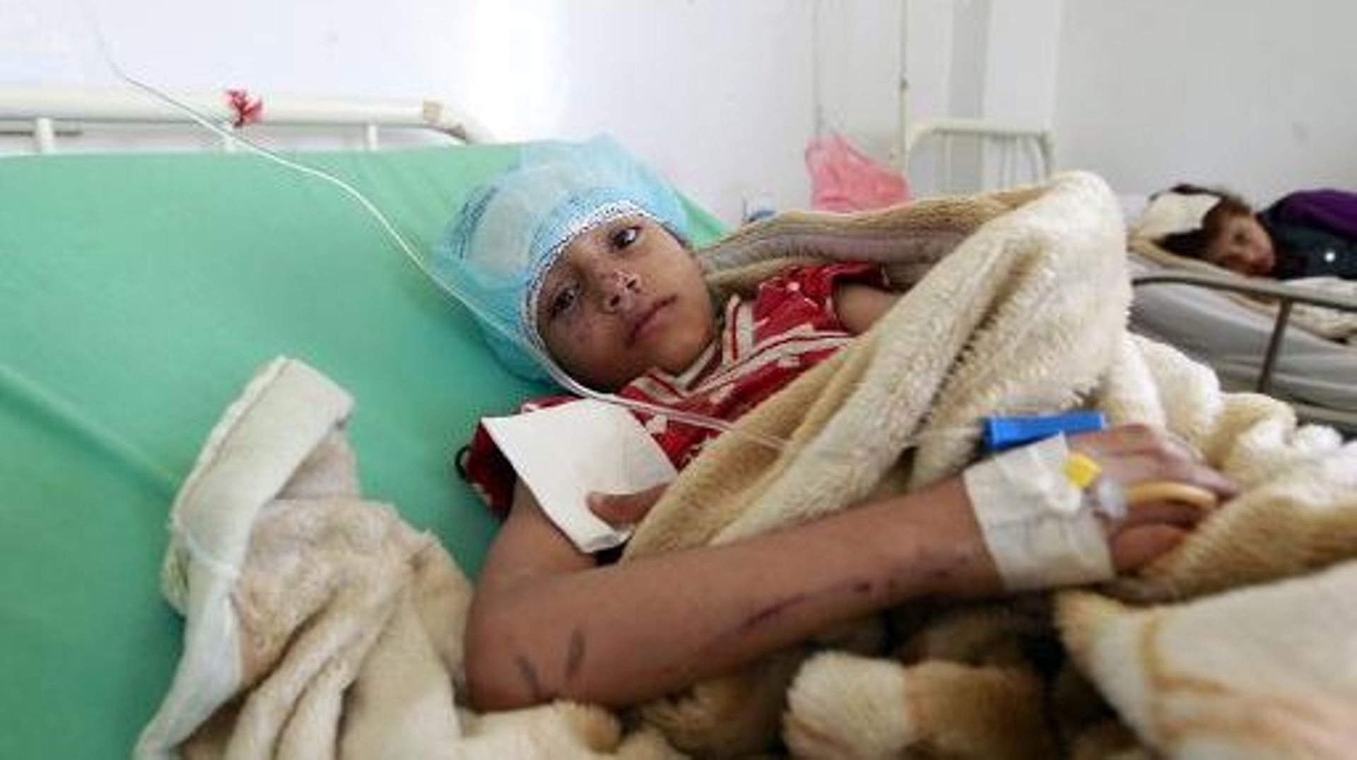 Un enfant blessé dans un hôpital de Sanaa au Yémen, le 12 mai 2015 